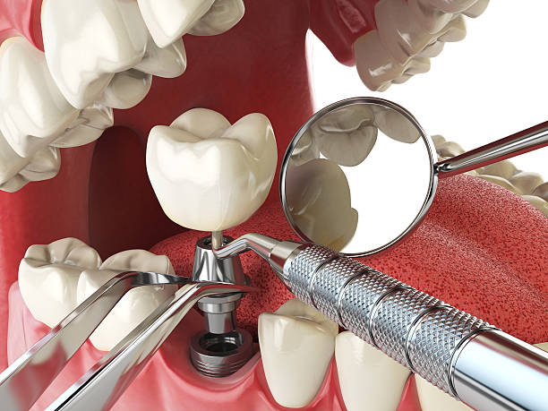 Best Weekend Emergency Dentist in Walnut Hill, TN